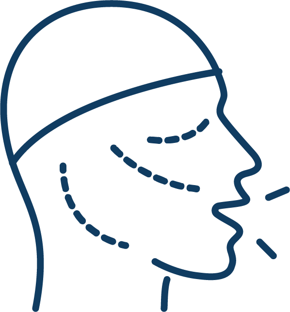 An outline of a head in profile with dashed lines indicating surgical markings on the face and neck. The person appears to be speaking.